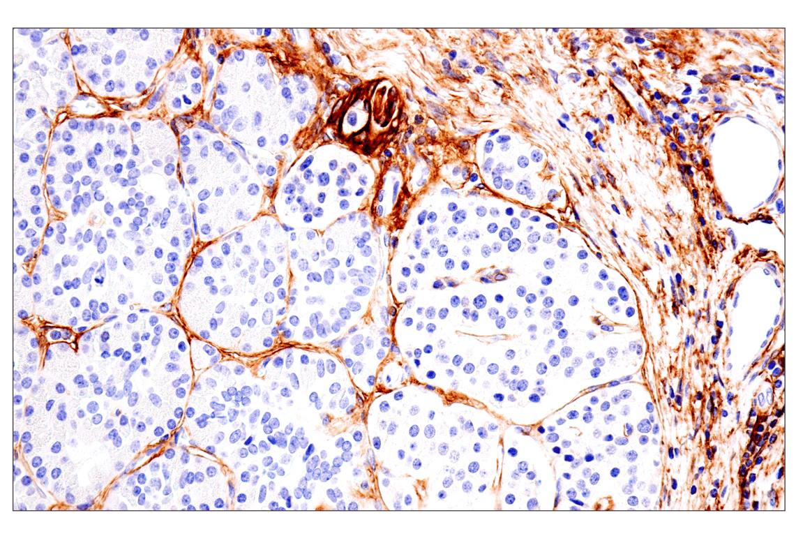 Immunohistochemistry Image 10: p75NTR (E7I3M) Rabbit Monoclonal Antibody (BSA and Azide Free)