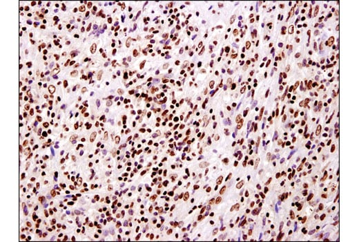undefined Image 15: Acetyl-Histone Antibody Sampler Kit