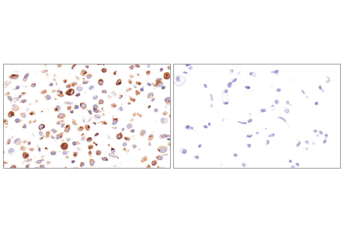 Immunohistochemistry Image 5: KISS1 (E6H9S) Rabbit Monoclonal Antibody