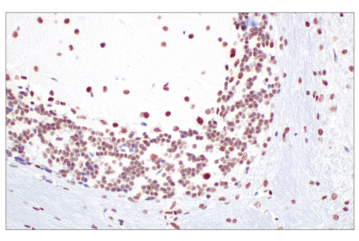 Immunohistochemistry Image 13: CBX7 (E7N1W) Rabbit Monoclonal Antibody