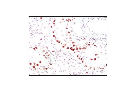Immunohistochemistry Image 2: Oct-4A (C52G3) Rabbit Monoclonal Antibody