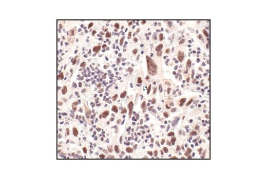 Immunohistochemistry Image 2: Survivin (71G4B7) Rabbit Monoclonal Antibody (BSA and Azide Free)