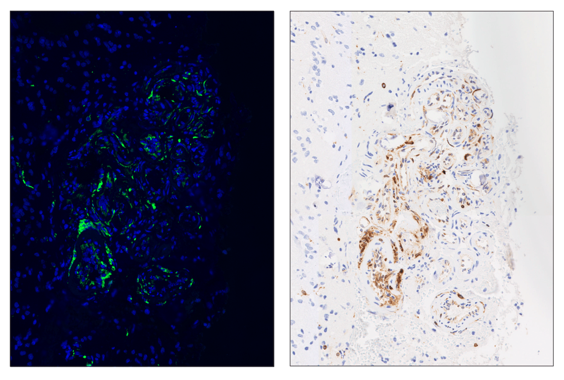 Immunohistochemistry Image 3: CD74 (D5N3I) & CO-0210-488 SignalStar<sup>®</sup> Oligo-Antibody Pair