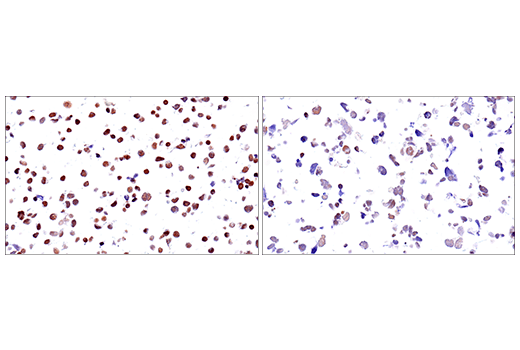 Immunohistochemistry Image 2: SETD2 (E4W8Q) Rabbit Monoclonal Antibody (IHC Formulated)