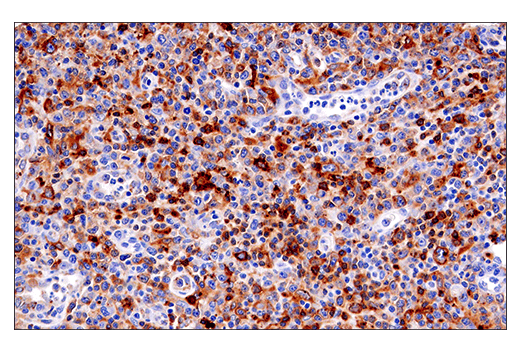 Immunohistochemistry Image 4: HLA-DRA (E9R2Q) XP<sup>®</sup> Rabbit mAb (BSA and Azide Free)