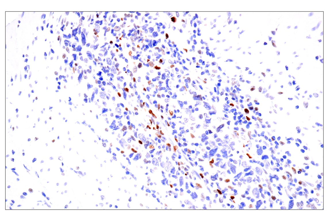 Immunohistochemistry Image 3: BATF3 (E3F3L) Rabbit Monoclonal Antibody (BSA and Azide Free)