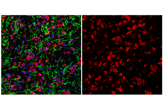 Immunofluorescence Image 2: YTHDF2 (E2I2H) Rabbit Monoclonal Antibody