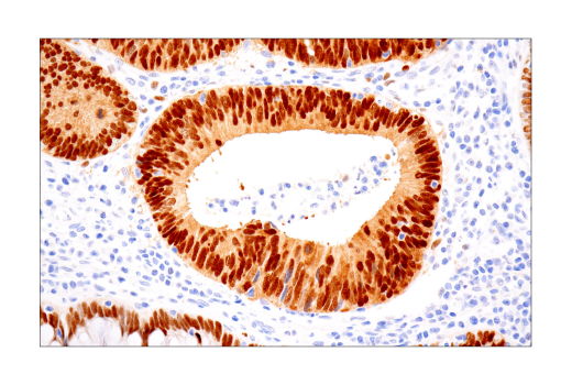 Immunohistochemistry Image 2: Sox9 (D8G8H) Rabbit Monoclonal Antibody