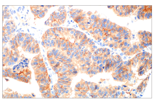 Immunohistochemistry Image 3: HER3/ErbB3 (D22C5) Rabbit Monoclonal Antibody