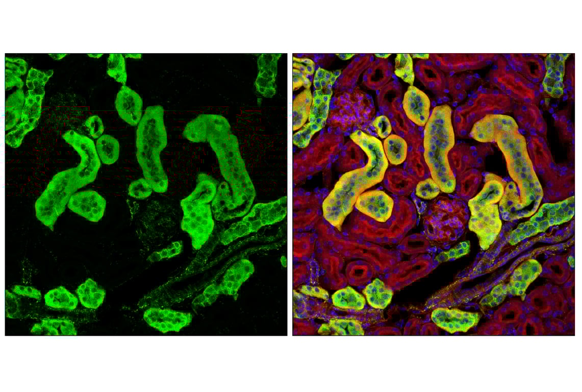Immunofluorescence Image 3: Hexokinase I (C35C4) Rabbit Monoclonal Antibody (BSA and Azide Free)