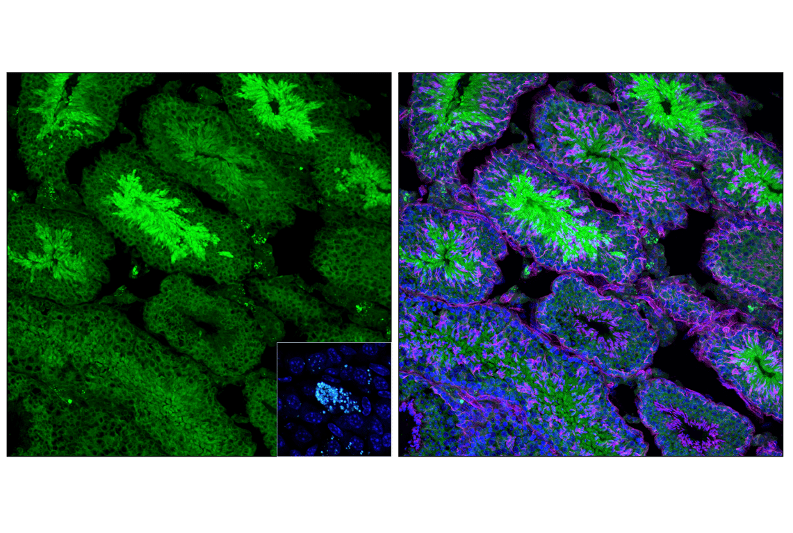 Immunofluorescence Image 1: Atg7 (F4V2N) Rabbit Monoclonal Antibody