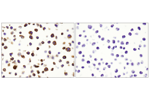 Immunohistochemistry Image 7: CD68 (D4B9C) XP<sup>®</sup> Rabbit mAb (BSA and Azide Free)