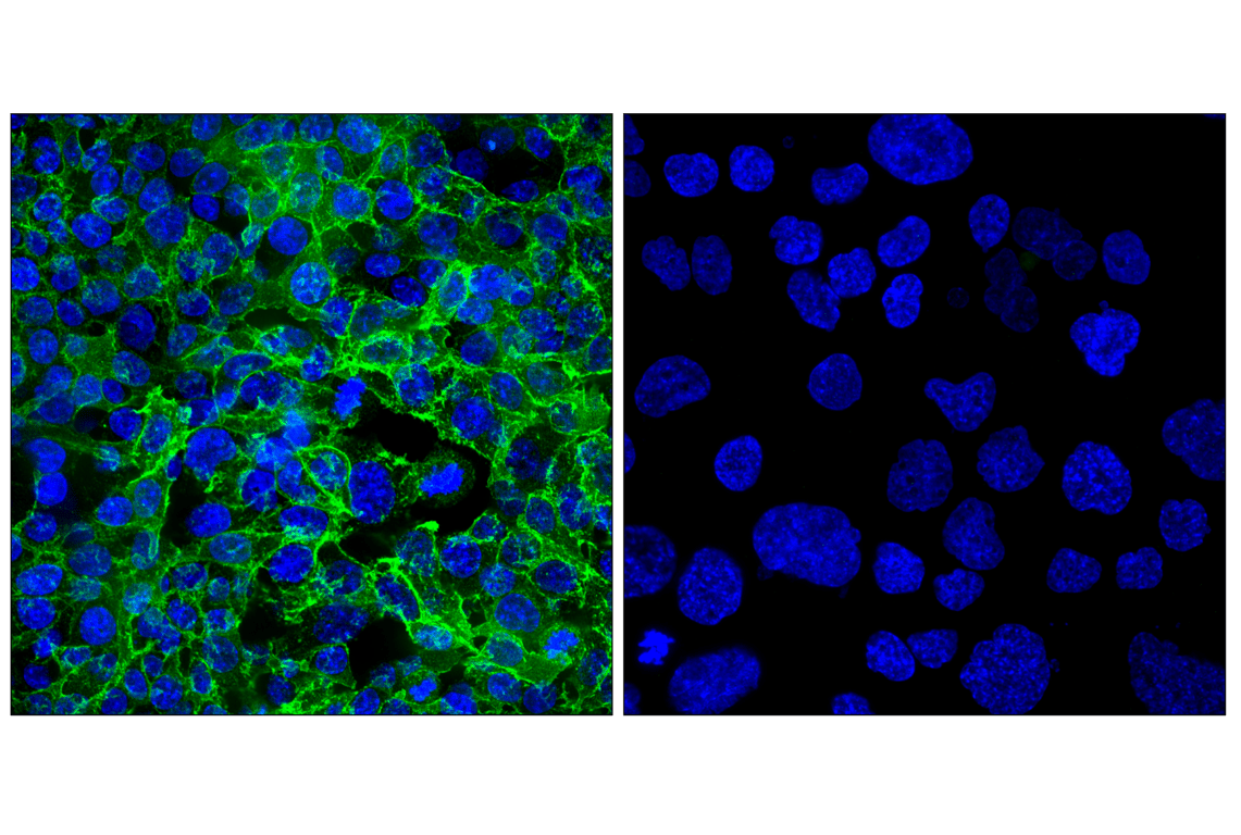 Immunofluorescence Image 1: AKAP12 (F4H6G) Rabbit Monoclonal Antibody