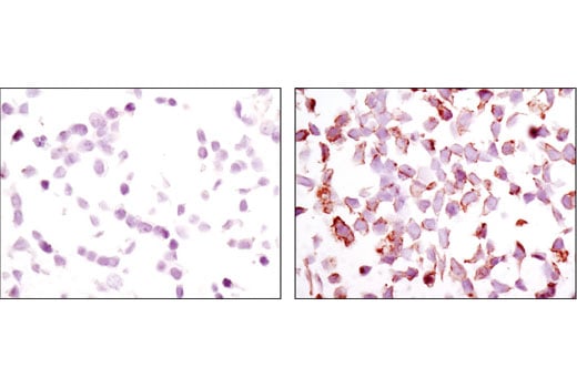 Immunohistochemistry Image 4: Phospho-HER3/ErbB3 (Tyr1289) (D1B5) Rabbit Monoclonal Antibody (BSA and Azide Free)