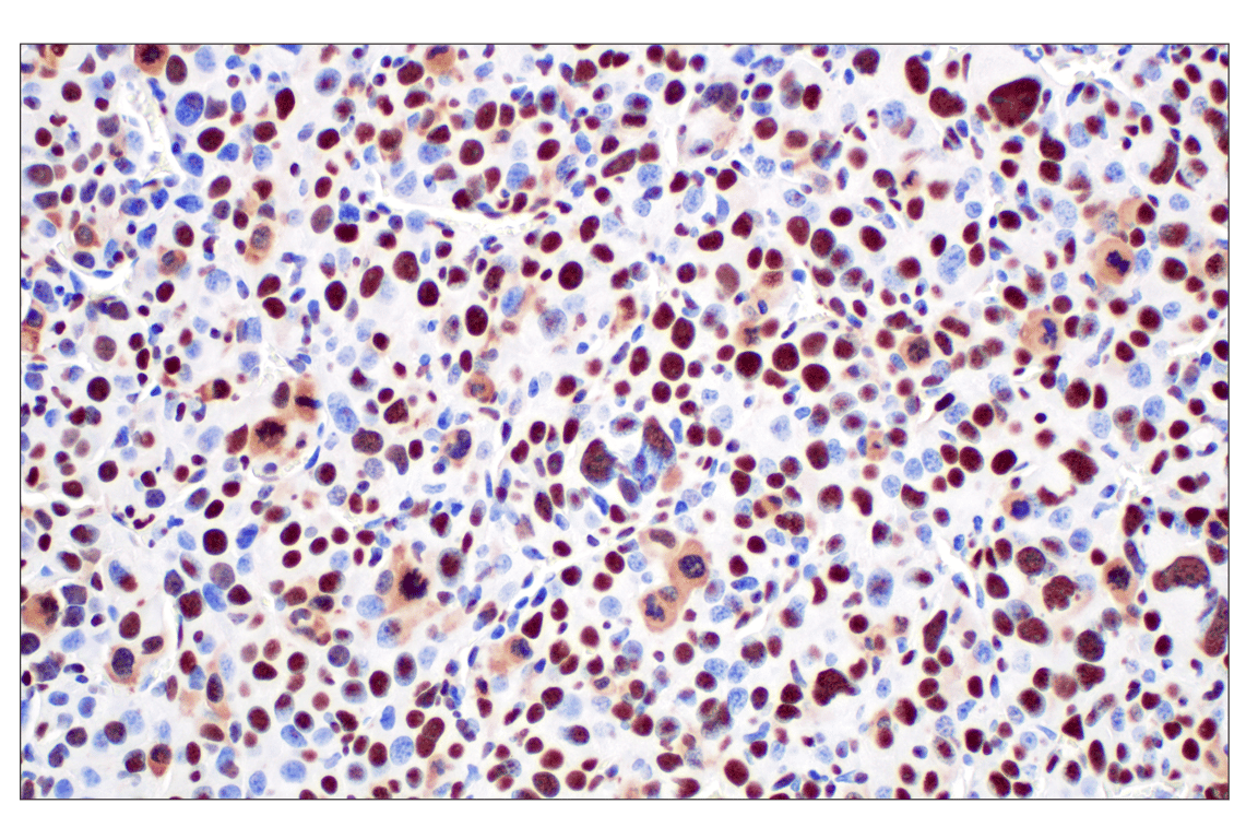 Immunohistochemistry Image 7: NPM1 (E7W4P) Rabbit Monoclonal Antibody