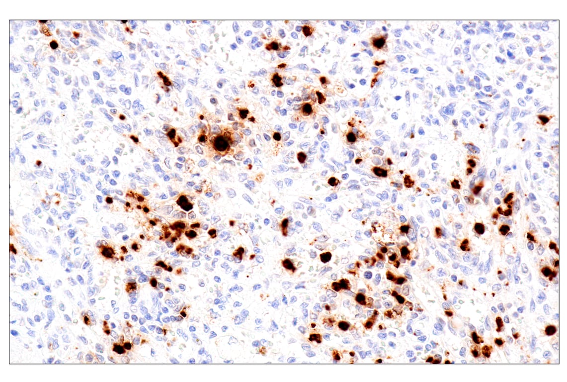 Immunohistochemistry Image 7: Eosinophil cationic protein (E6U5M) Rabbit Monoclonal Antibody (BSA and Azide Free)