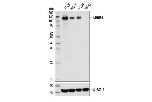 Western Blotting Image 1: EphB4 (D1C7N) Rabbit mAb (BSA and Azide Free)