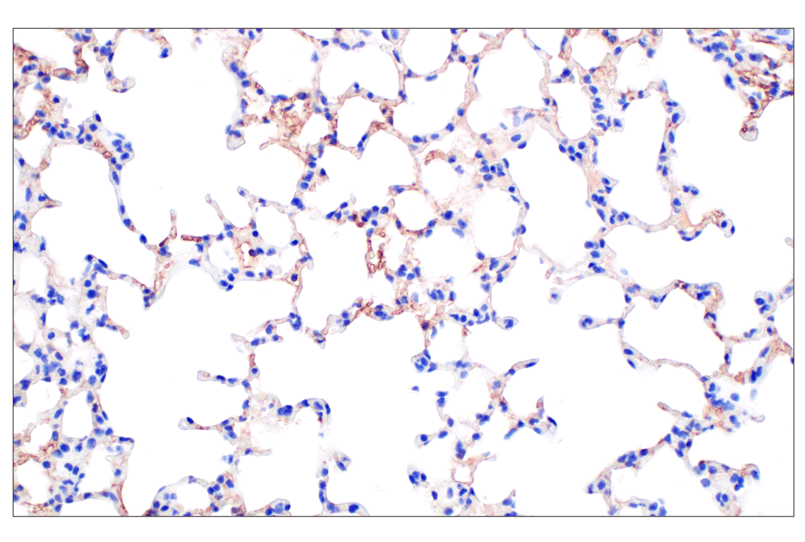 Immunohistochemistry Image 5: PNPLA3 (E7N6O) Rabbit Monoclonal Antibody (BSA and Azide Free)