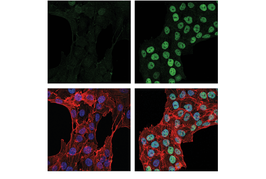 Immunofluorescence Image 1: XBP-1s (E7M5C) Mouse Monoclonal Antibody
