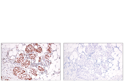 Immunohistochemistry Image 3: RPA32/RPA2 (E8X5P) Rabbit Monoclonal Antibody (BSA and Azide Free)