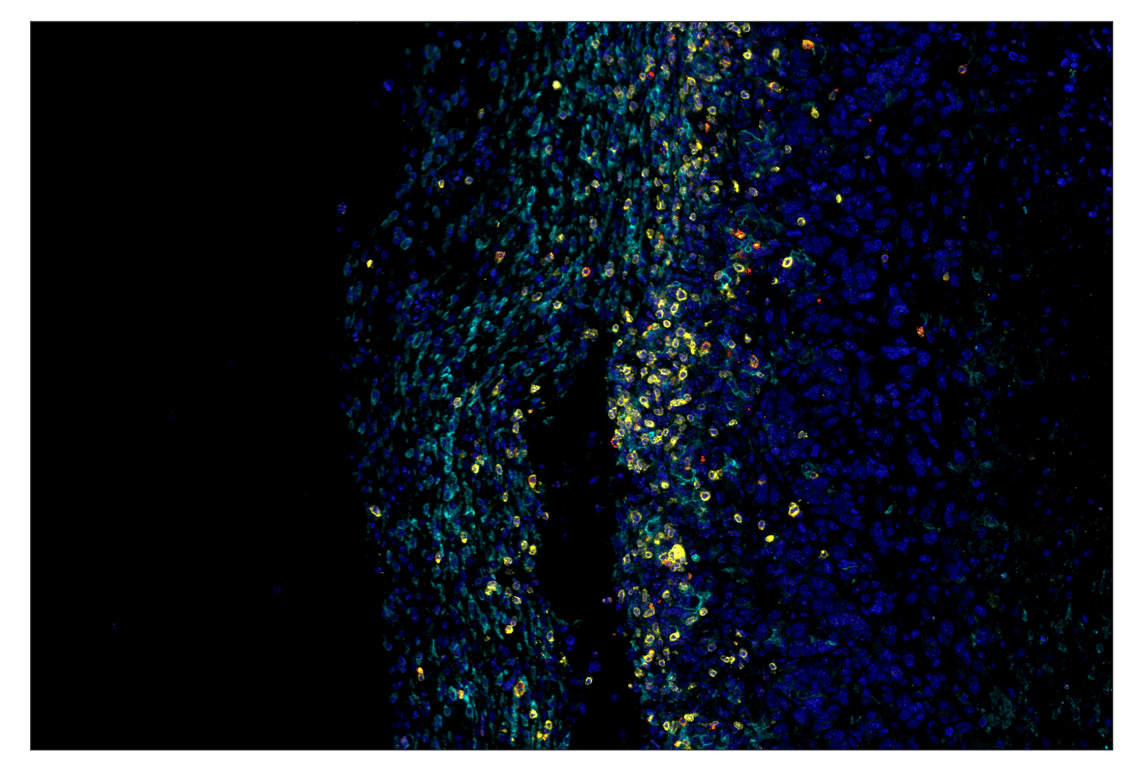 Immunohistochemistry Image 7: CD3 epsilon (E4T1B) & CO-0048-647 SignalStar<sup>™</sup> Oligo-Antibody Pair