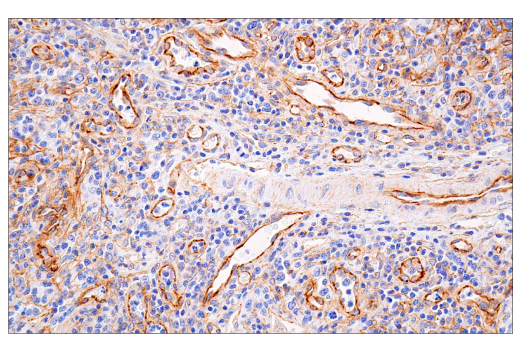 Immunohistochemistry Image 6: beta-Catenin (15B8) Mouse Monoclonal Antibody