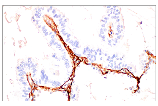 Immunohistochemistry Image 3: Periostin (E5F2S) Rabbit Monoclonal Antibody (BSA and Azide Free)
