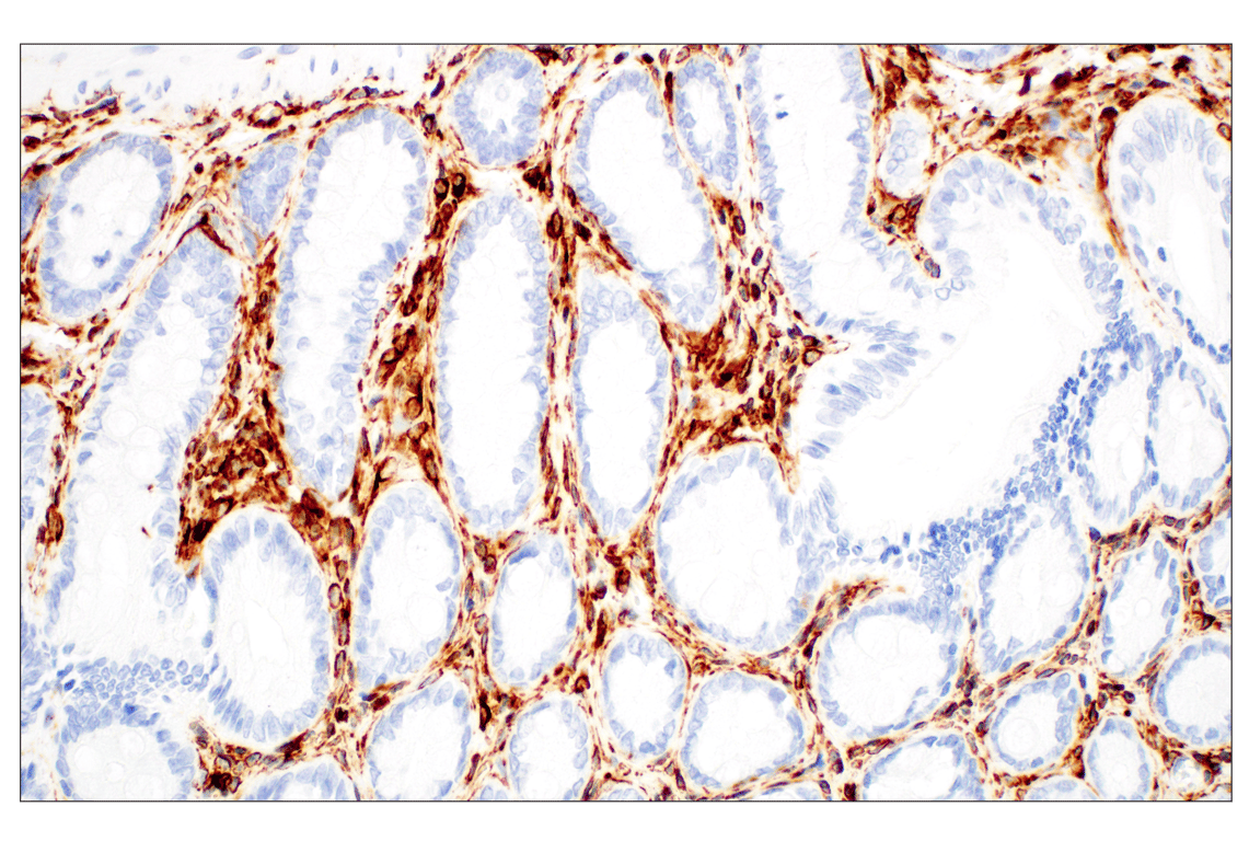 Immunohistochemistry Image 3: Vimentin (D21H3) Rabbit Monoclonal Antibody (BSA and Azide Free)