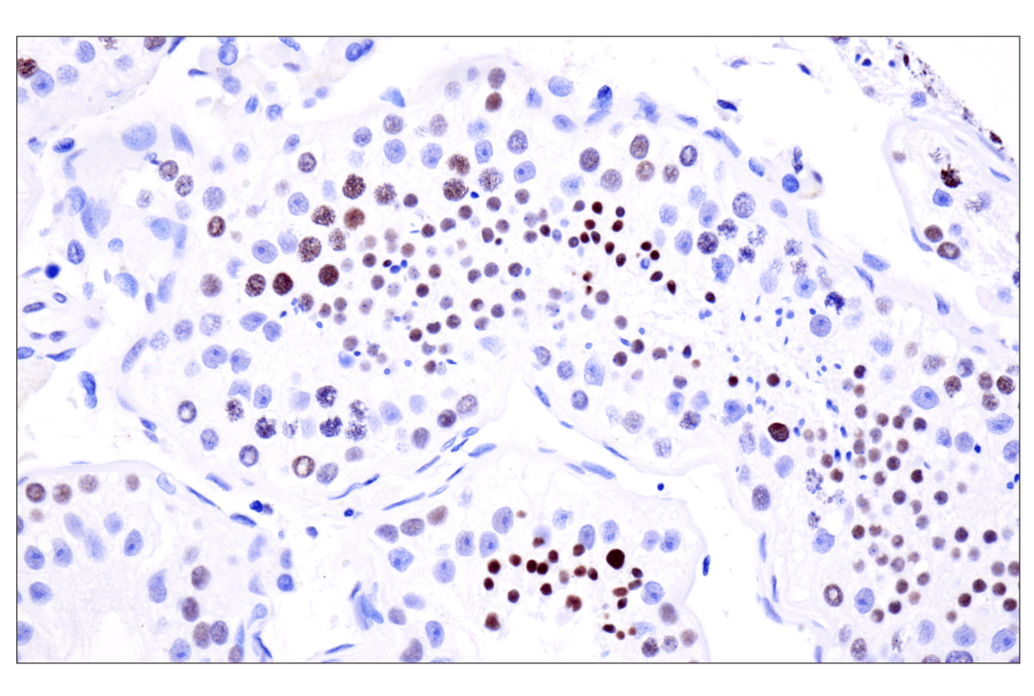 Immunohistochemistry Image 7: Acetyl-Histone H4 (Lys16) (E2B8W) Rabbit Monoclonal Antibody
