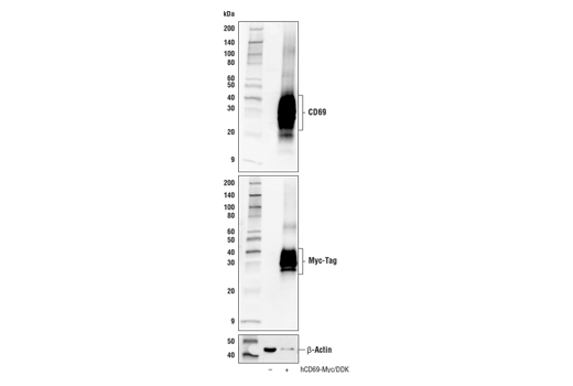 Western Blotting Image 2: CD69 (E1U2O) Rabbit Monoclonal Antibody