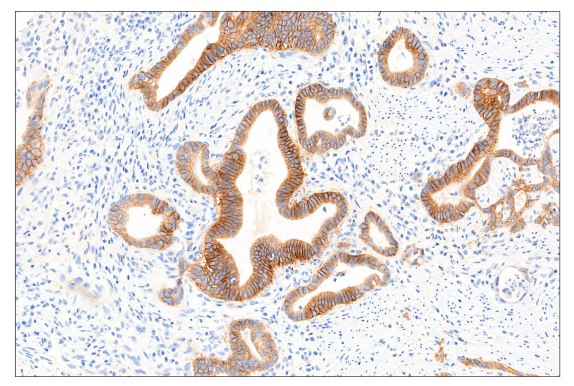 Immunohistochemistry Image 2: FGF Receptor 2IIIb (FPR2-D) Mouse Monoclonal Antibody