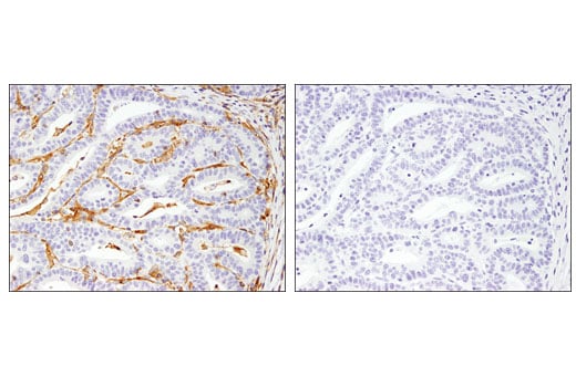 Immunohistochemistry Image 2: Kindlin-3 (D8I7V) Rabbit Monoclonal Antibody
