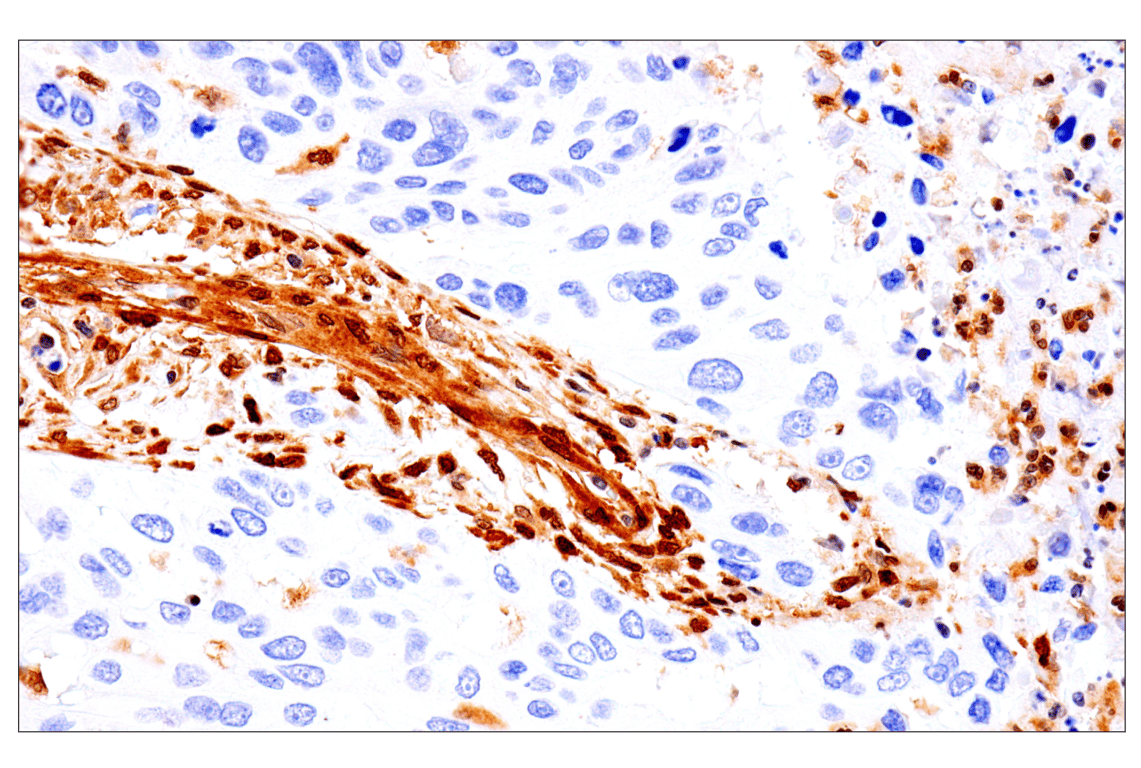 Immunohistochemistry Image 3: PTEN (D4.3) Rabbit Monoclonal Antibody (BSA and Azide Free)