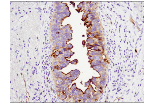 Immunohistochemistry Image 2: CEACAM1 (D3R8O) Rabbit Monoclonal Antibody (BSA and Azide Free)
