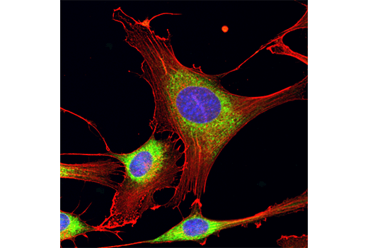 Immunofluorescence Image 1: Calreticulin (D3E6) XP<sup>®</sup> Rabbit mAb (Alexa Fluor<sup>®</sup> 488 Conjugate)