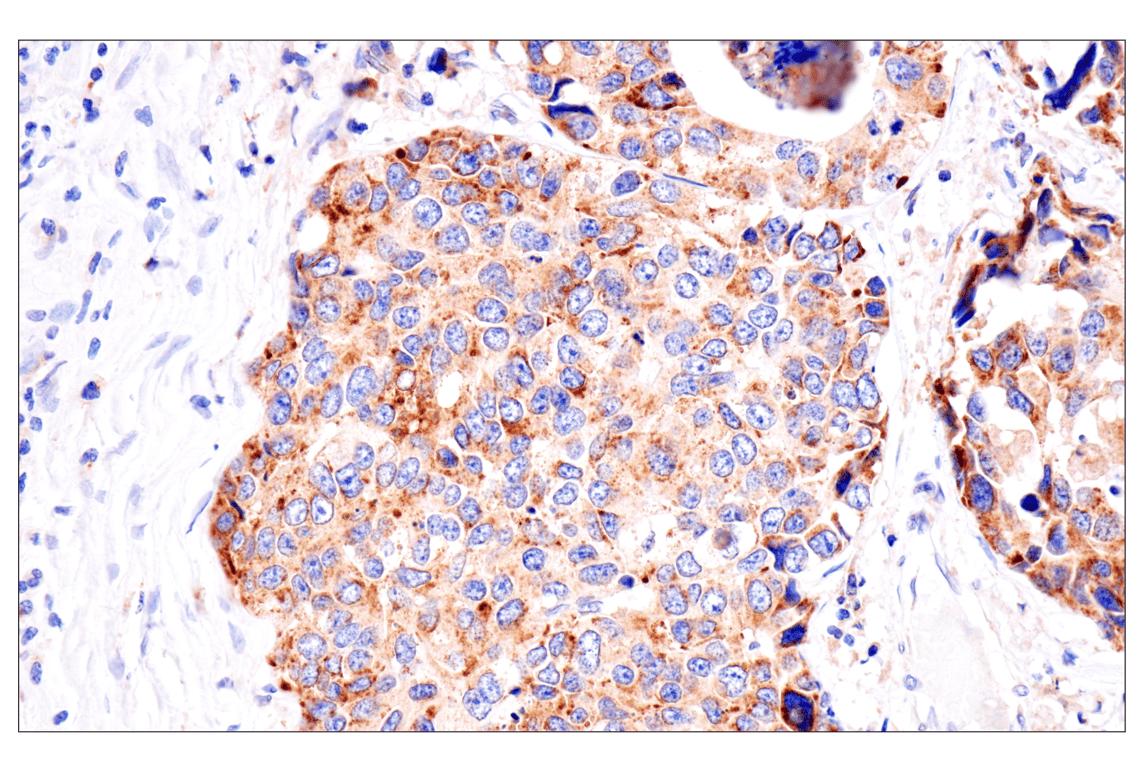 Immunohistochemistry Image 5: Presenilin 2 (F7E5Q) Rabbit Monoclonal Antibody