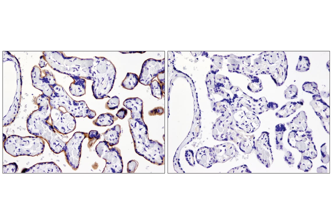 Immunohistochemistry Image 2: PD-L1 (E1L3N) Rabbit Monoclonal Antibody