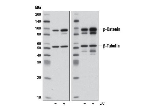 Western Blotting Image 2: Non-phospho (Active) beta-Catenin (Ser33/37/Thr41) (D13A1) Rabbit Monoclonal Antibody