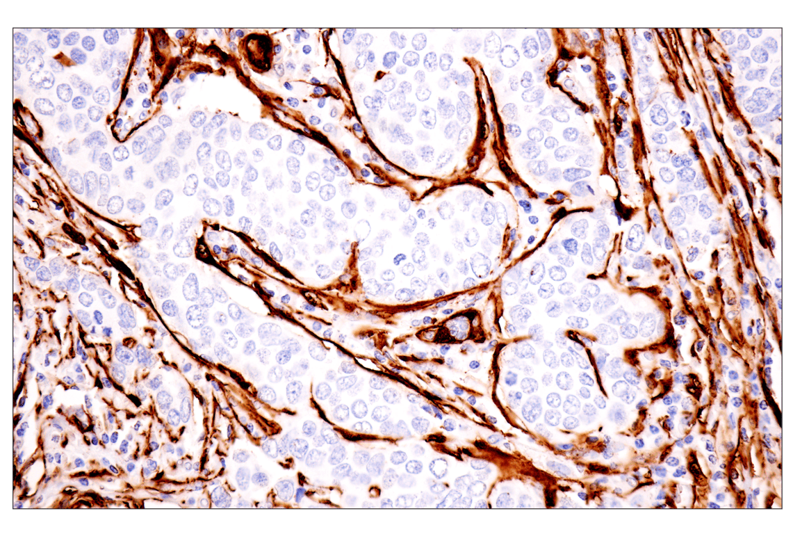 Immunohistochemistry Image 4: Transgelin/TAGLN (F3B7H) Rabbit Monoclonal Antibody