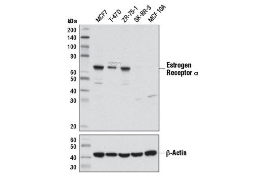 Western Blotting Image 1: Estrogen Receptor alpha (D8H8) Rabbit Monoclonal Antibody