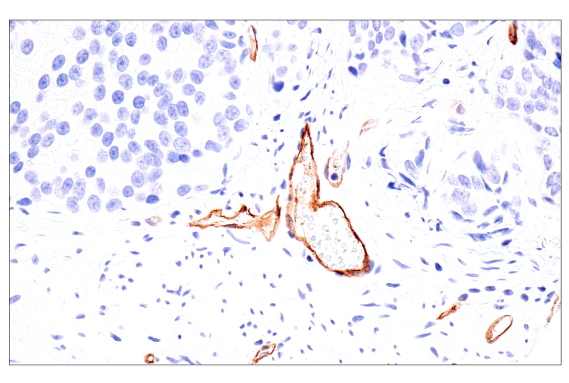 Immunohistochemistry Image 4: Claudin-5 (E5D9Y) Rabbit Monoclonal Antibody