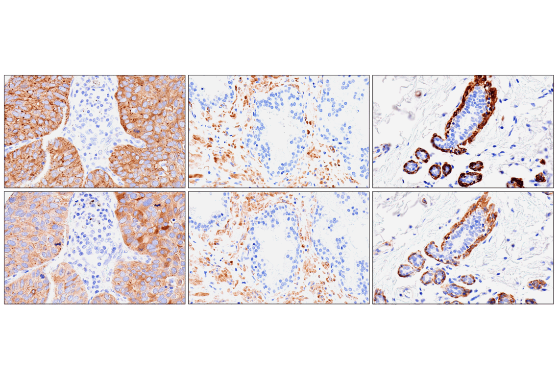 Immunohistochemistry Image 14: MYH11 (E4N8M) Rabbit Monoclonal Antibody (BSA and Azide Free)