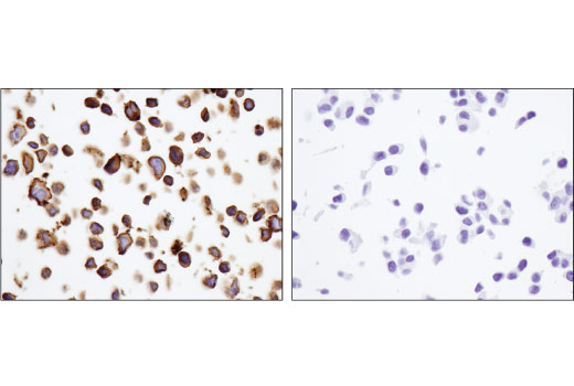 Immunohistochemistry Image 3: CD40 (D8W3N) Rabbit Monoclonal Antibody