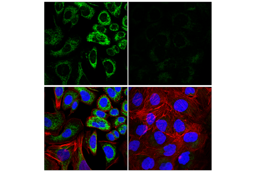 Immunofluorescence Image 1: FIS1 (E3K9O) Rabbit Monoclonal Antibody
