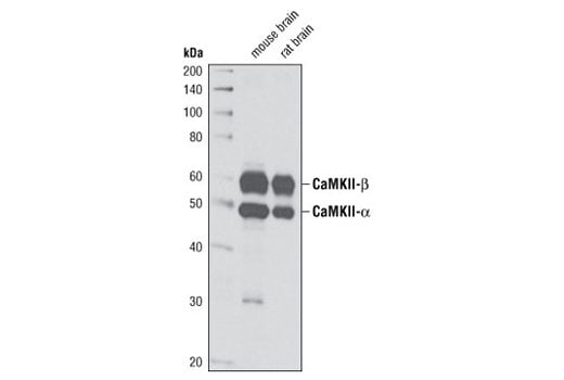 undefined Image 4: PhosphoPlus<sup>®</sup> CaMKII (Thr286) Antibody Duet