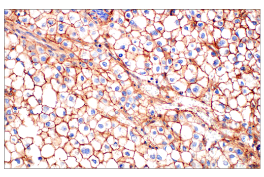 Immunohistochemistry Image 1: CD81 (D3N2D) Rabbit Monoclonal Antibody (BSA and Azide Free)