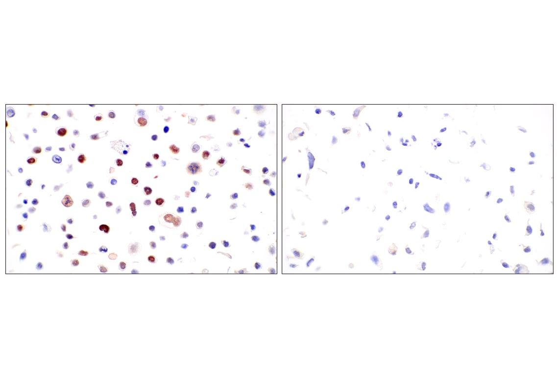Immunohistochemistry Image 11: BRCA1 (E5S9G) Rabbit Monoclonal Antibody