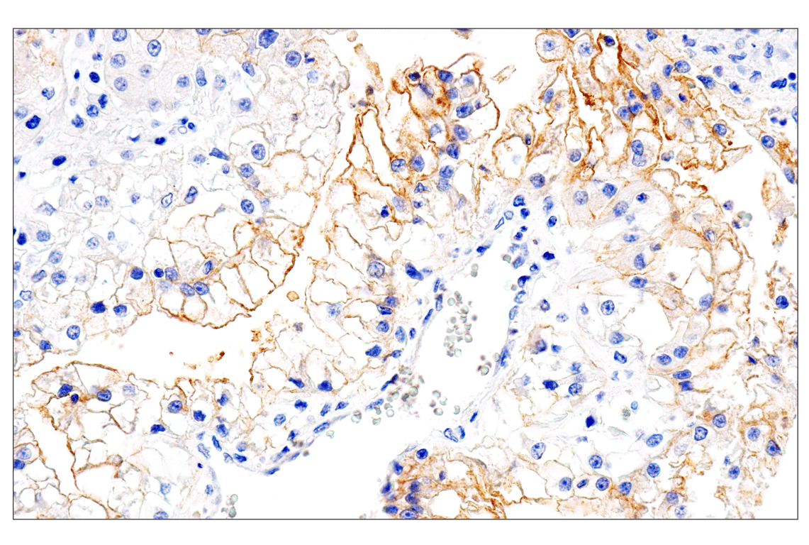 Immunohistochemistry Image 4: Folate Receptor Alpha/FOLR1 (BN3.2) Mouse Monoclonal Antibody