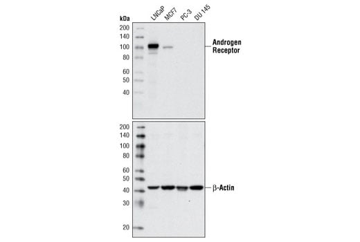 Western Blotting Image 2: Androgen Receptor (D6F11) Rabbit Monoclonal Antibody