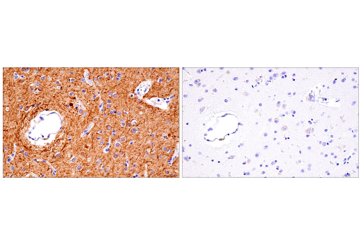 Immunohistochemistry Image 4: Neurofilament-M (E7L2T) Rabbit Monoclonal Antibody